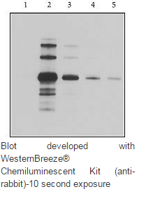blob100514186.png blob.png