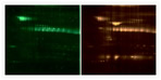 2D gel stained with the SYPRO Ruby protein gel stain and the Pro-Q Emerald 300 reagent.